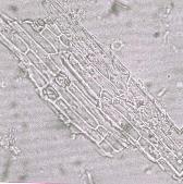 Epidermal cells