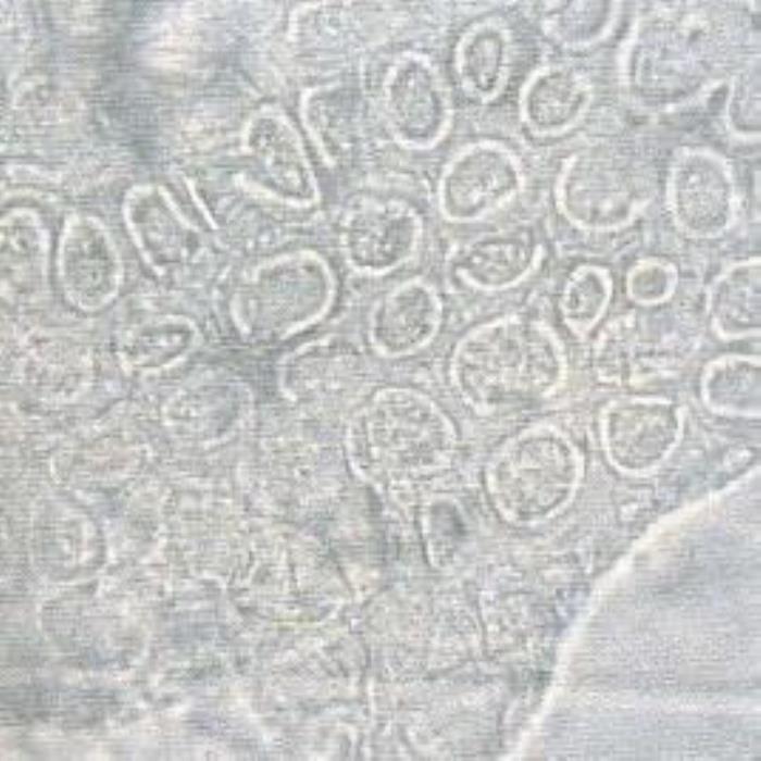 Parenchyma cells