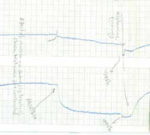 Bronchodilatory effects of Arnebia on histamine induced tracheal chain of the guinea pig