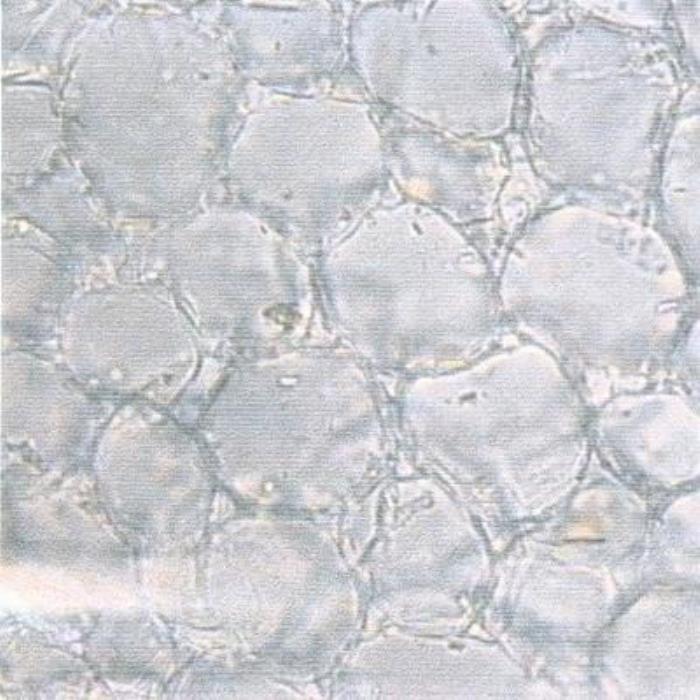 Surface view of stem pith
