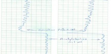 Contraction effect on acetylcholine treated detrusor muscle