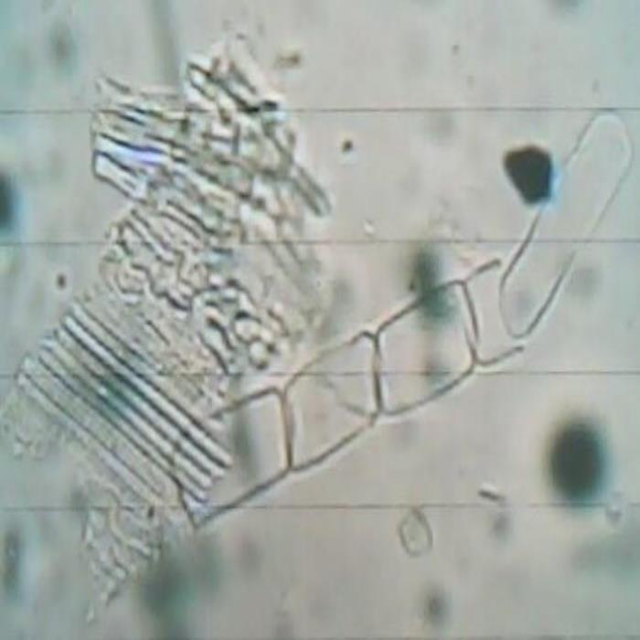 Surface of stem