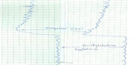 Effect on detrusor muscle